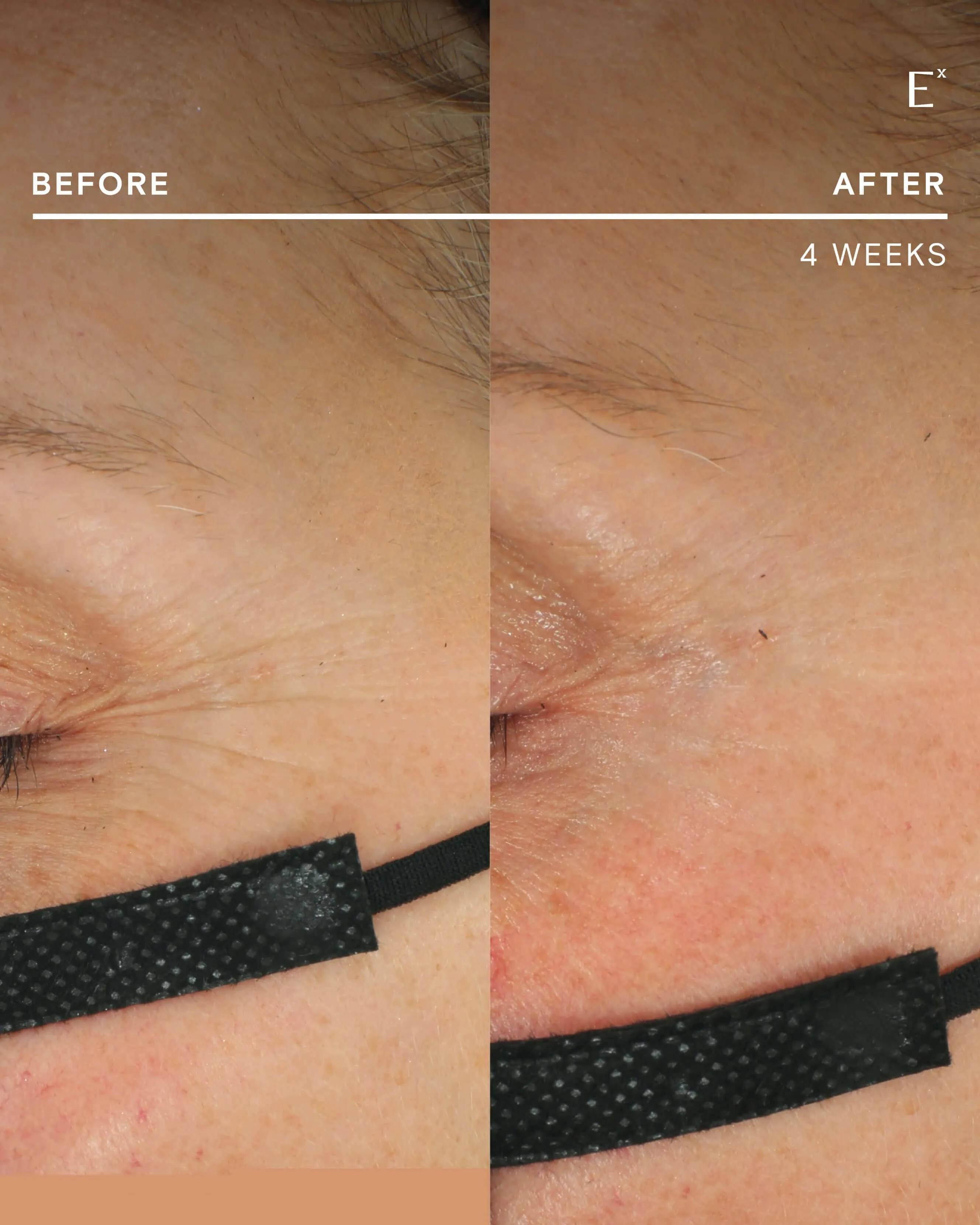 Firming Filter CoQ10 Antioxidant Powder Serum & Refill