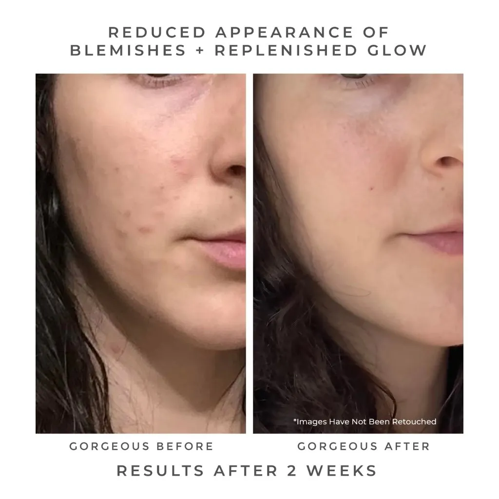 Oasis Deep Pore Gel Cleanser
